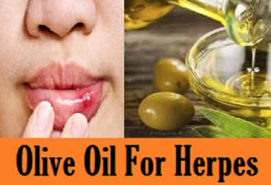 olive oil for herpes